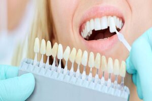 Cosmetic Dentistry