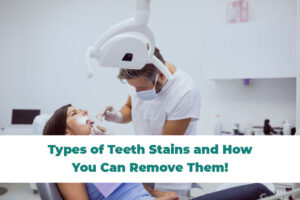 Teeth Stains