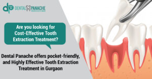 tooth extraction