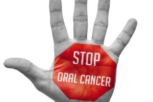 Oral Cancer