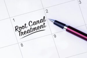 Root Canal Treatment