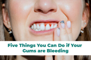 Gum Bleeding