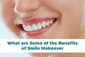 Smile Makeover