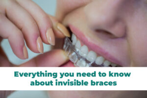 Invisible Braces