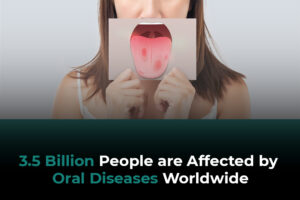 3.5 Billion People are Affected by Oral Diseases Worldwide