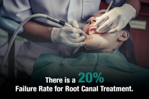 There is a 20% Failure Rate for Root Canal Treatment.