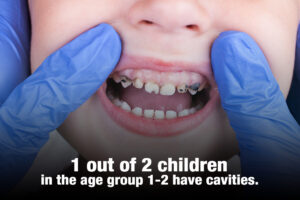 1 out of 2 children in the age group 1-2 have cavities.