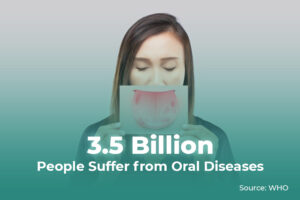 3.5 Billion People Suffer from Oral Diseases