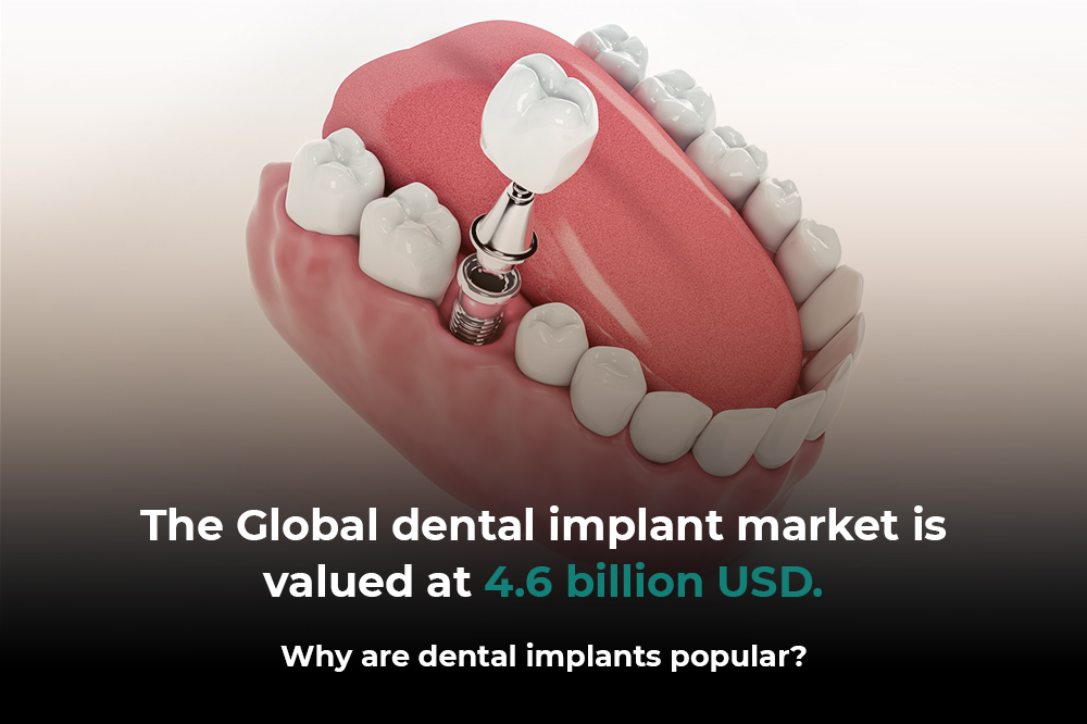 The Global dental implant market is valued at 4.6 billion USD. Why are dental implants popular
