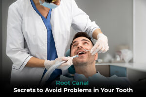 Root Canal Treatment