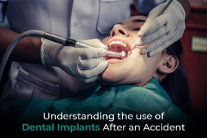 Dental Implant Surgery