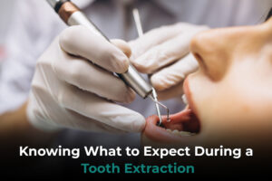 Knowing-what-to-expect-during-a-tooth-extraction