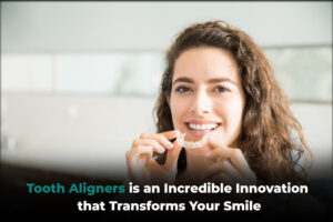 Tooth-Aligners-is-an-incredible-innovation-that-transforms-your-smile