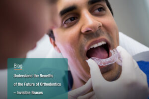 Understand-the-Benefits-of-the-Future-of-Orthodontics-–-Invisible-Braces