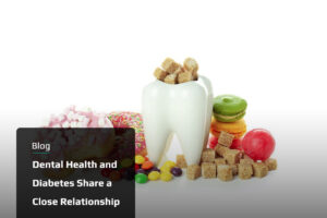 Dental-Health-and-Diabetes-Share-a-Close-Relationship