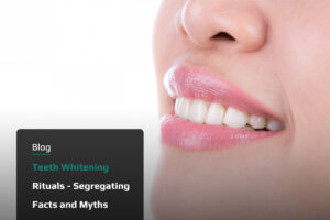 Teeth Whitening