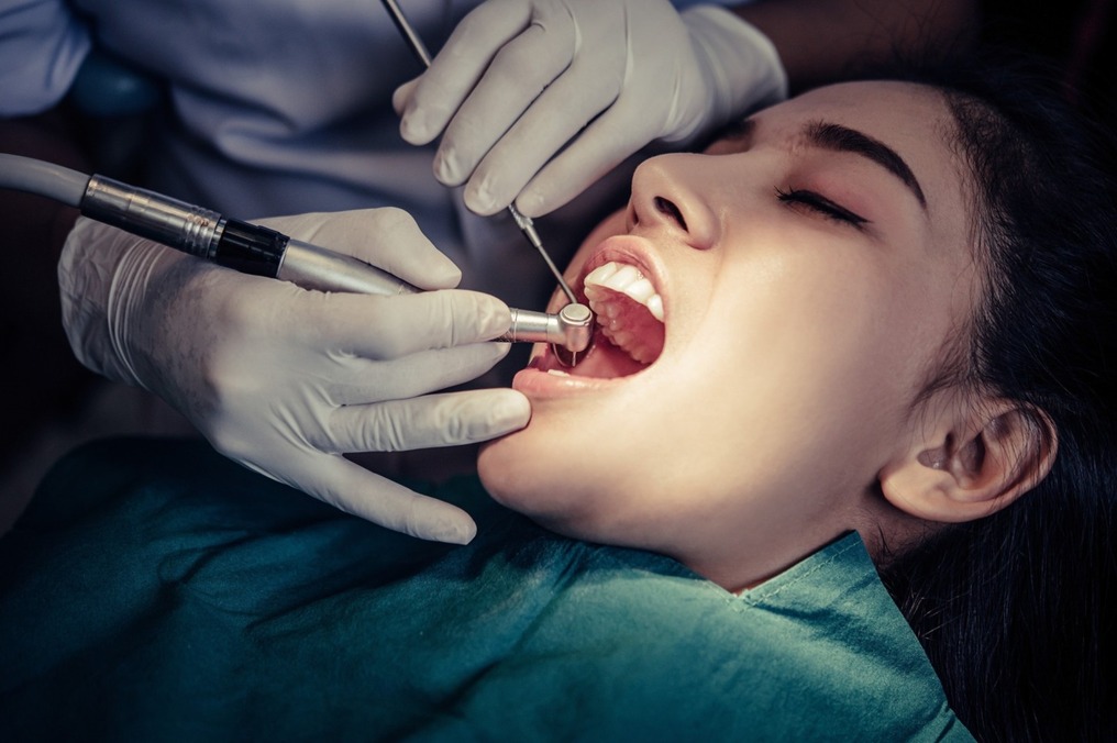 cracked teeth symptoms and treatment